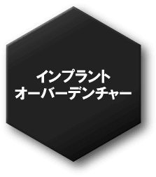 オーバーデンチャー