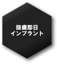 抜歯即日(抜歯即時)インプラント